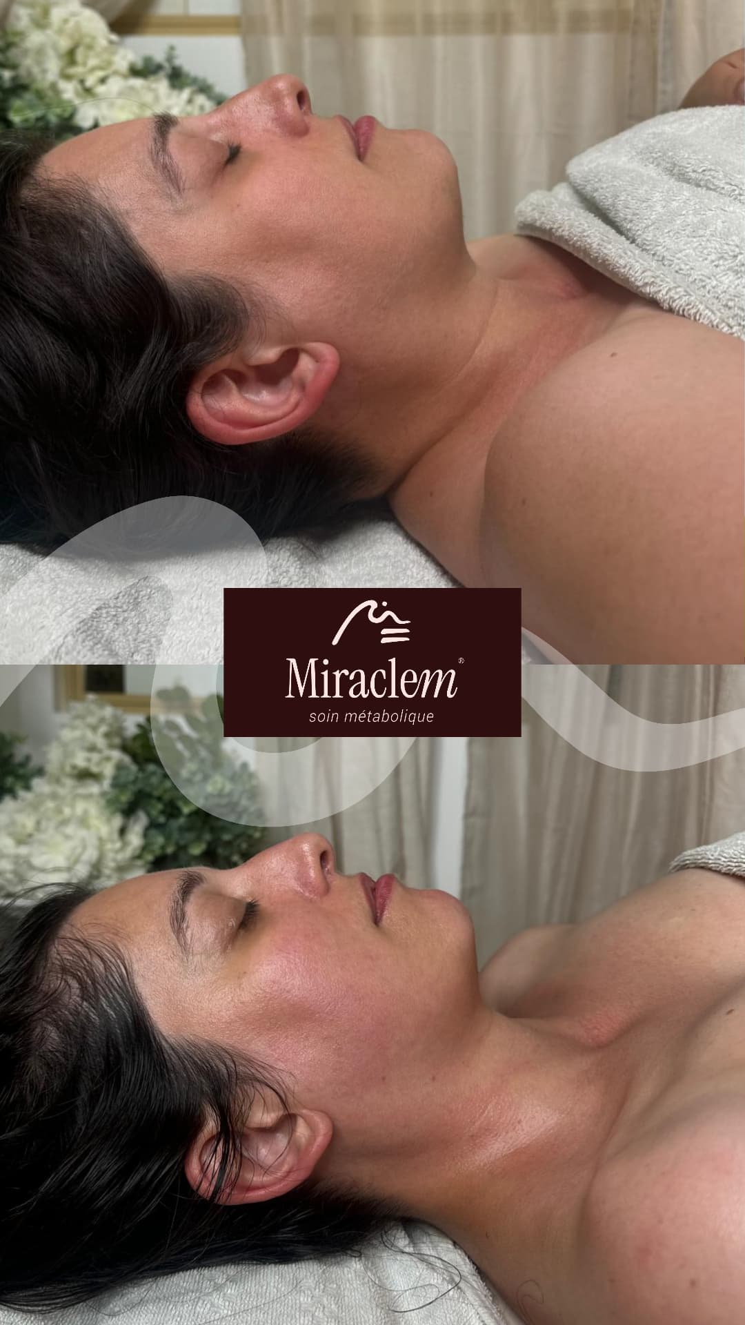 Résultat Miraclem : Visage & cou · 1 séance